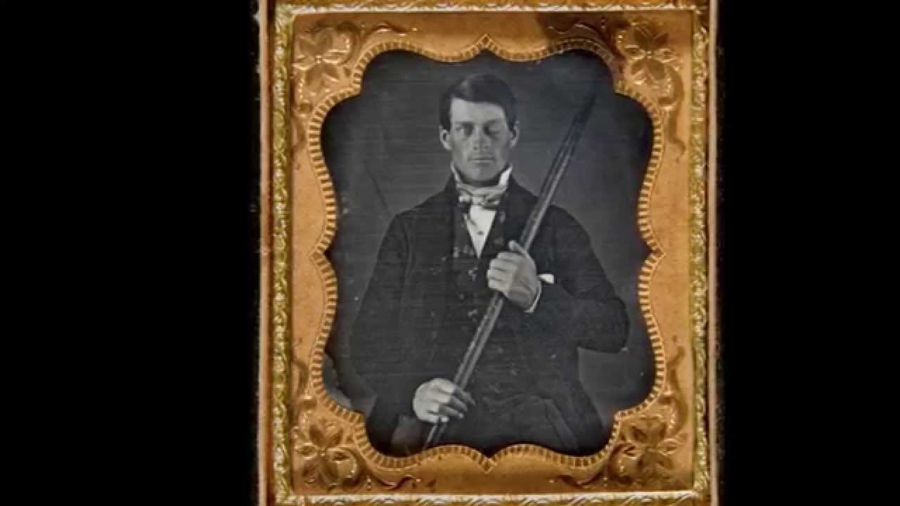 A Rod Through His Brain The Story of Phineas Gage RallyPoint