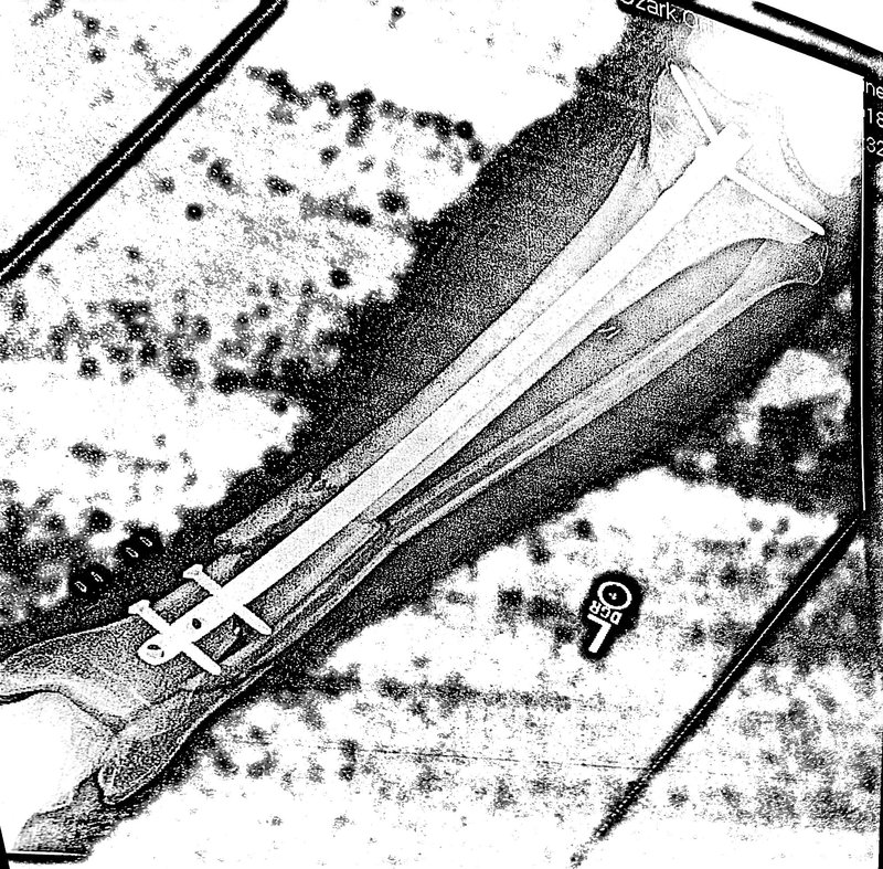 What is the probability of being medically discharged or retained with